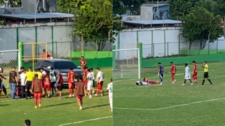 Así le quedó el rostro a jugador de reservas que sufrió accidente en partido