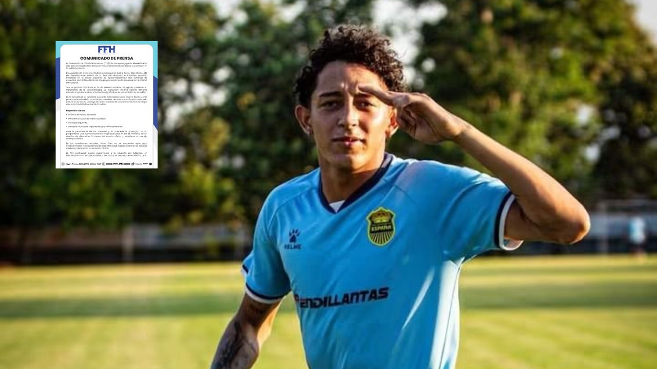 Federación confirma la lesión que dejó fuera a Nixon Cruz de la selección