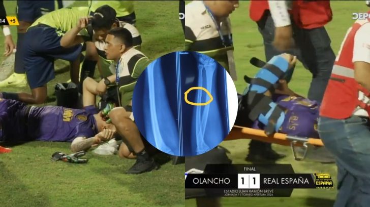 Olancho FC confirma gravedad de la lesión de Denovan Torres
